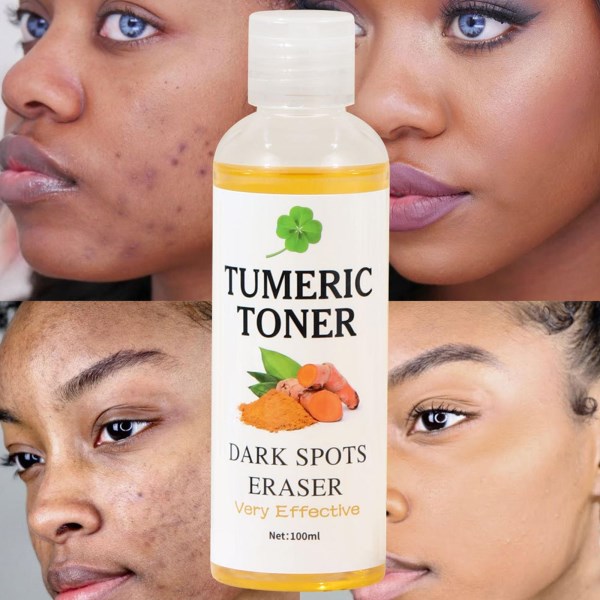 Новый Tumeric Toner Dark Spots Toner Spots Eraser Corrector Turmeric Fade Blemishe Dark Spot Remover Acne Remover Dark Skin Care